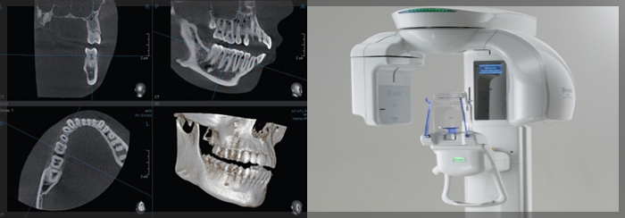 dental xray medford oregon